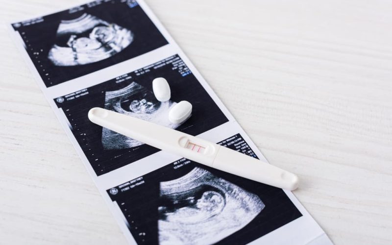 Citrato de clomifeno y SOP: guía para personas de  Bolivia